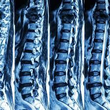 ls spine ct scan cost