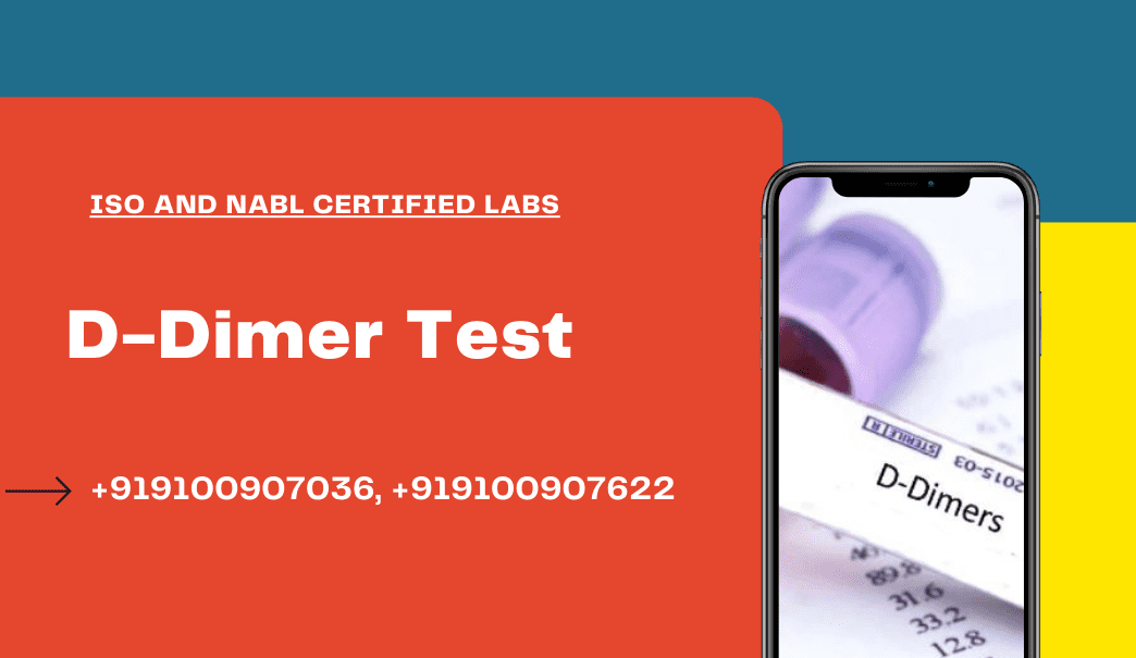 D-Dimer Test