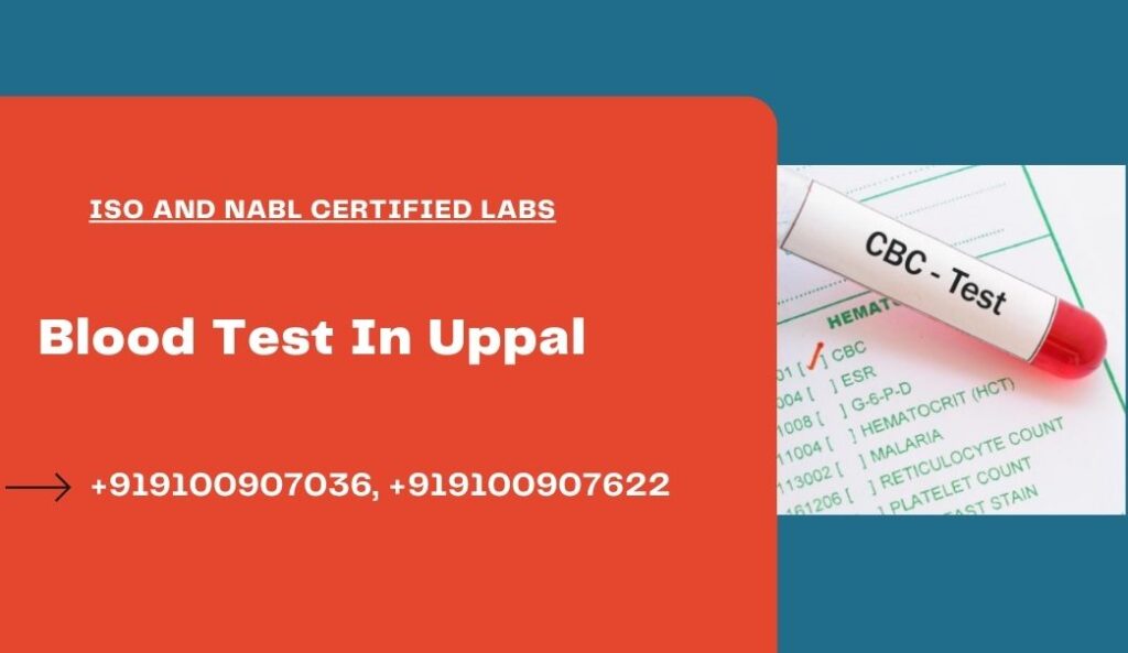 Blood test at home Uppal