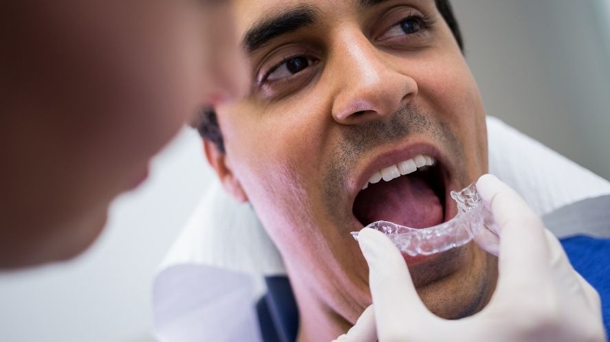 invisible braces
