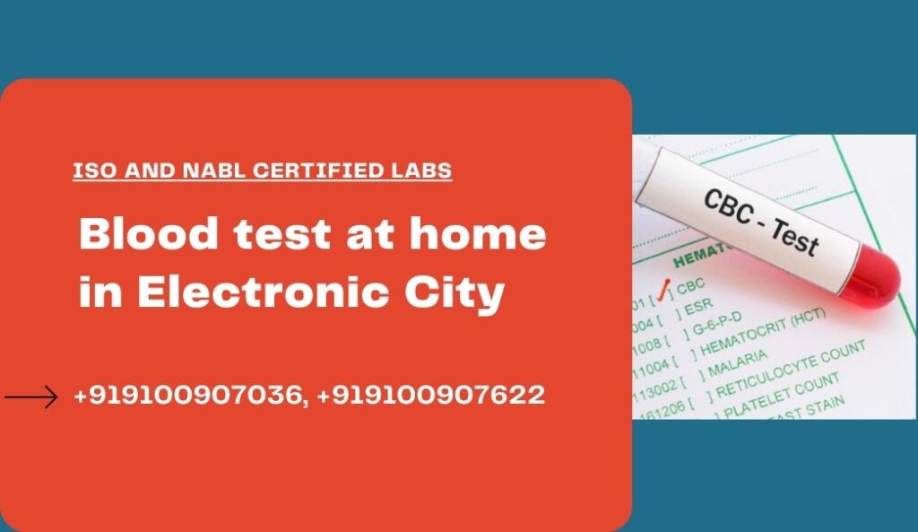 Blood test at home in Electronic City