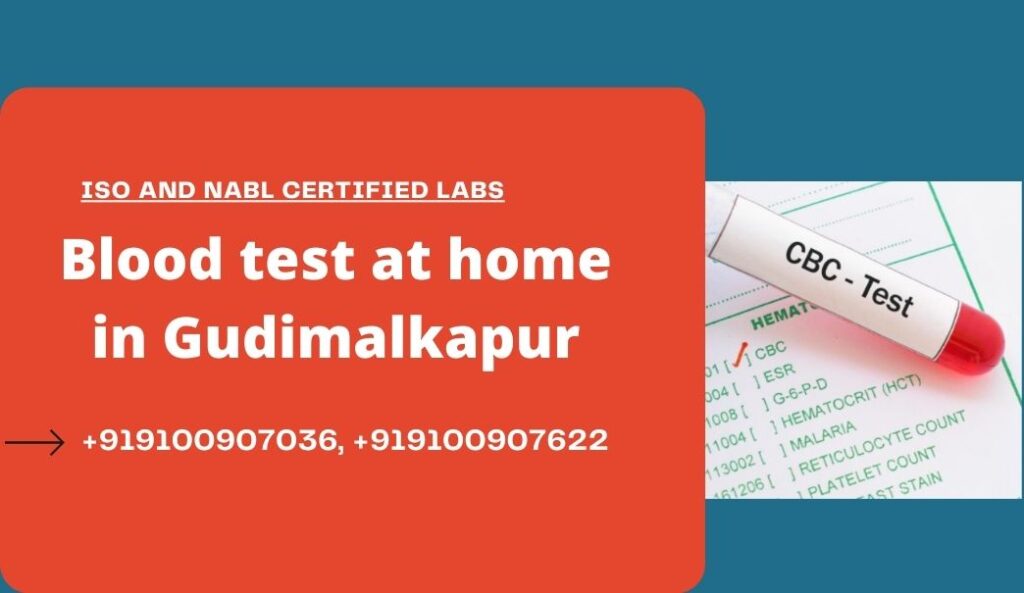 Blood test in Gudimalkapur