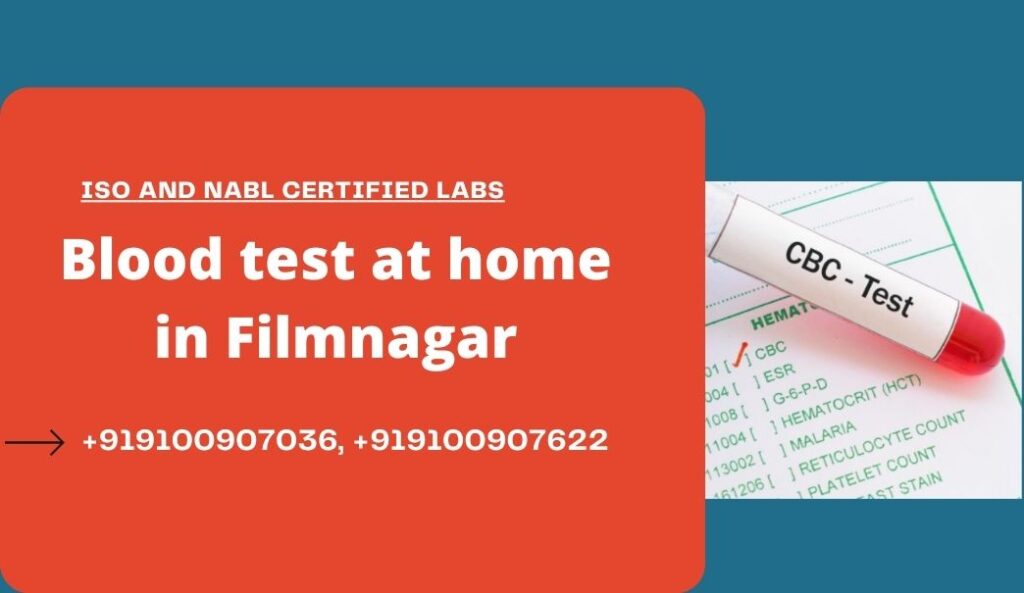 Blood test in Filmnagar