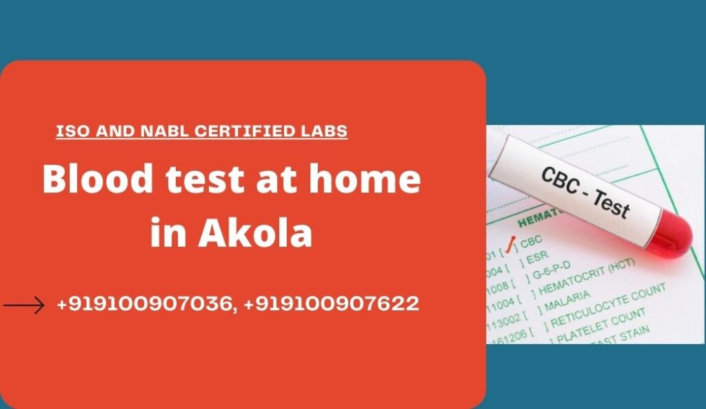 Blood Test At Home In Akola