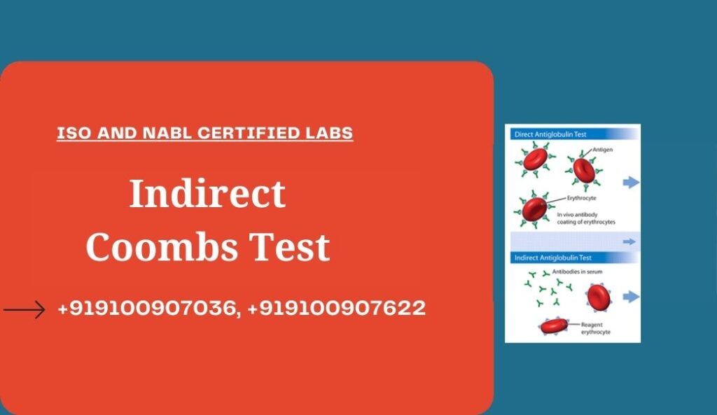 indirect coombs test