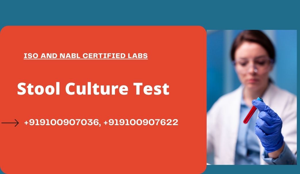 stool culture test