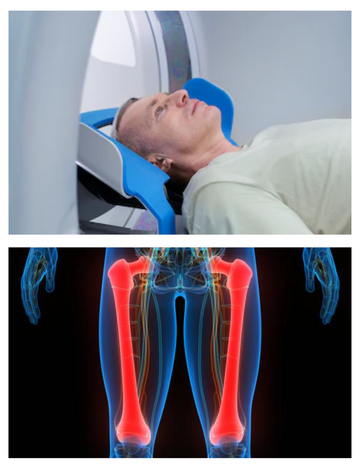 CT scan for Femur in Hyderabad