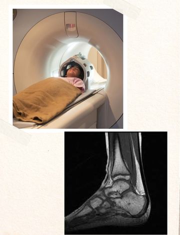 mri ankle joint