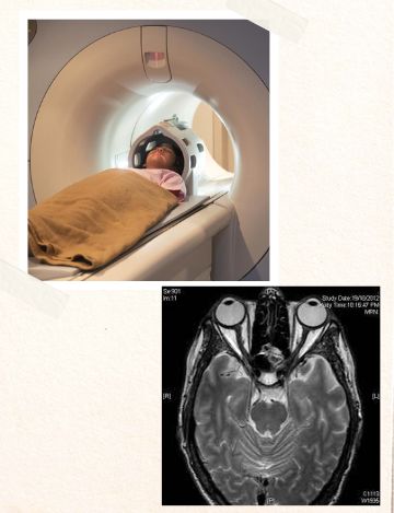 Mri scan for pancreas