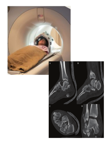 ankle joint ct