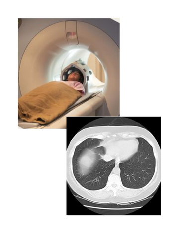 CT Scan for lungs