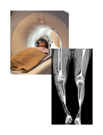 ct for leg