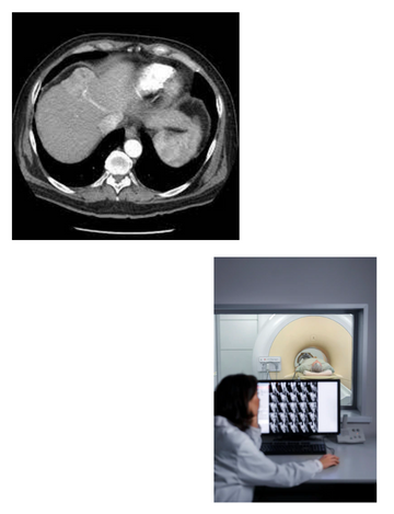 triphasic liver