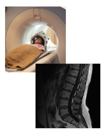 spine ct