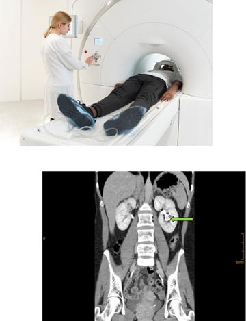 CT Scan for Urogram in Hyderabad