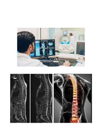 Whole spine screening