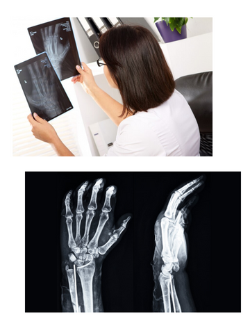 CT scan for left wrist in hyderabad