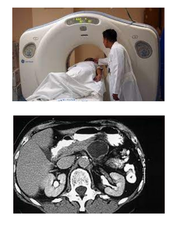 upper abdomen