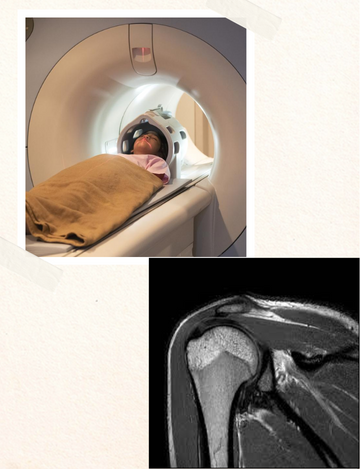 Mri shoulder