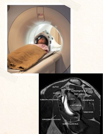 Mri scan for arthrography