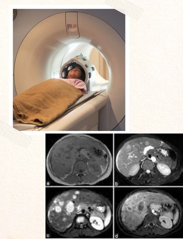 MRI Scan for triphasic liver