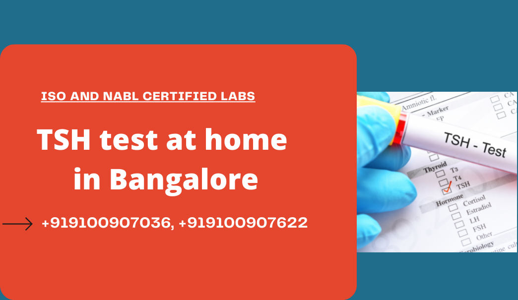 TSH Test cost in Bangalore