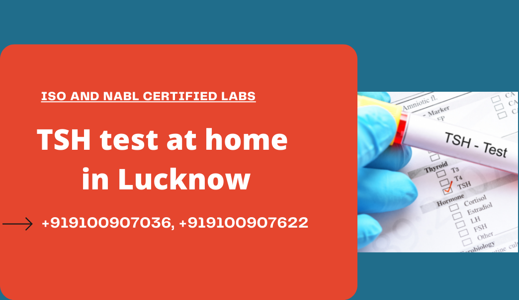 TSH test cost in lucknow