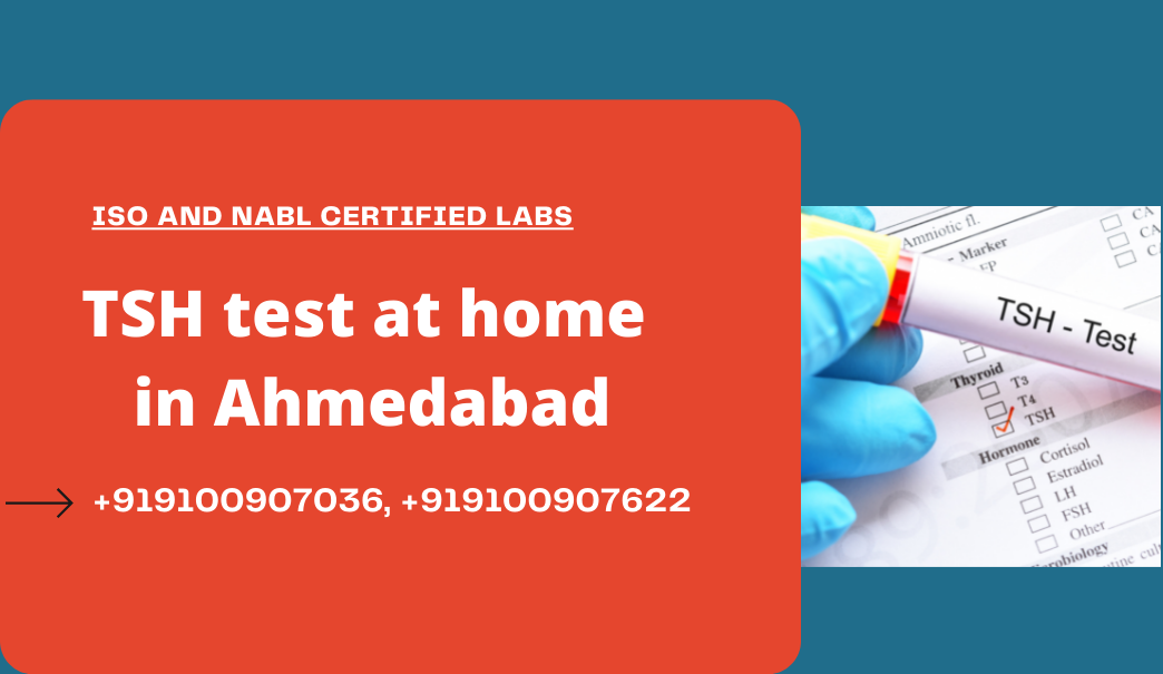 TSH Test Cost in Ahmedabad