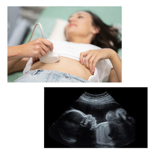 Growth scan with doppler