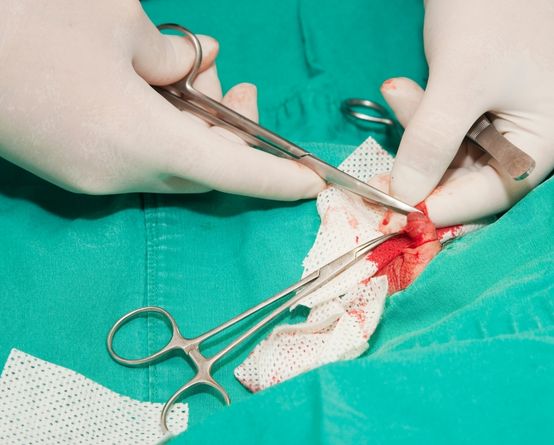 circumcision