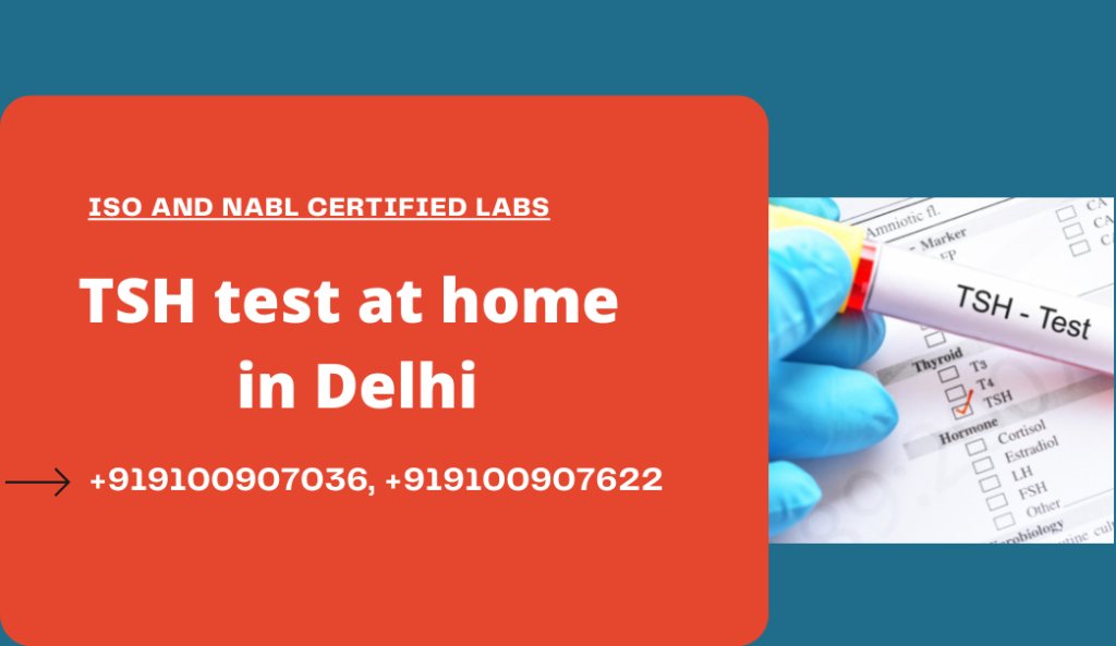 TSH Test delhi