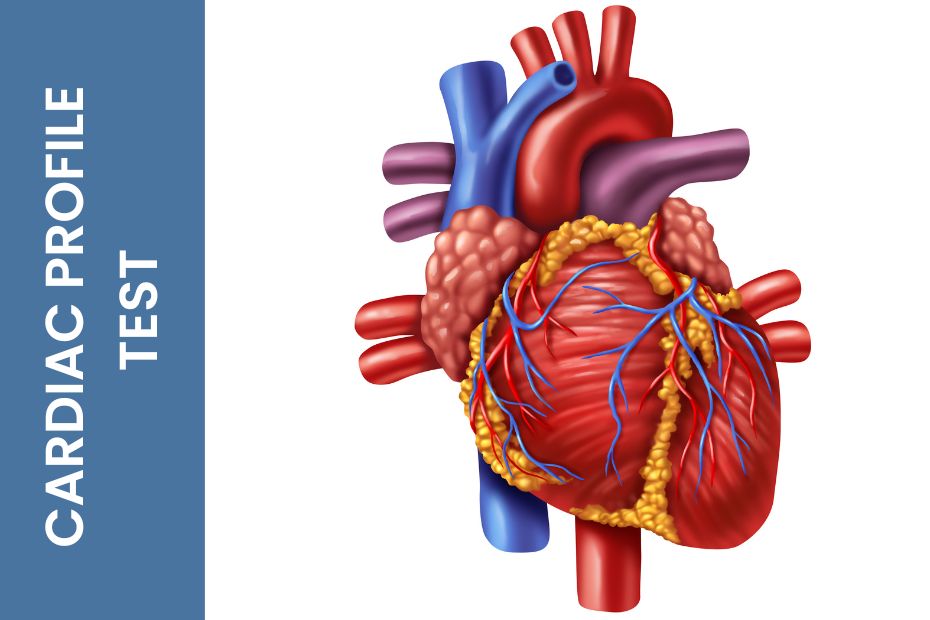 Cardiac test