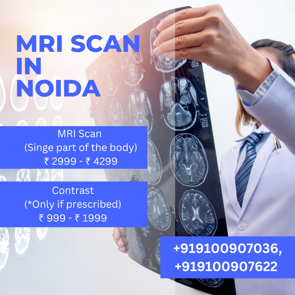 MRI scan in Noida