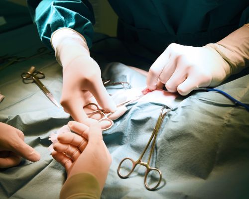 procedure for hydrocele surgery