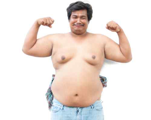 causes of gynecomastia