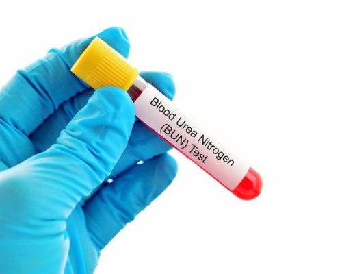 Blood Urea Nitrogen Test