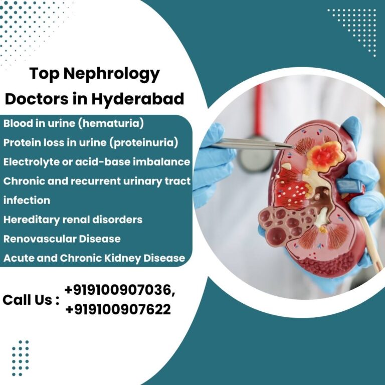 Nephrologist in Hyderabad