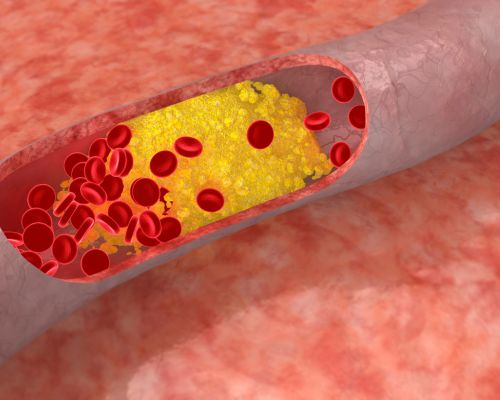 Cholesterol