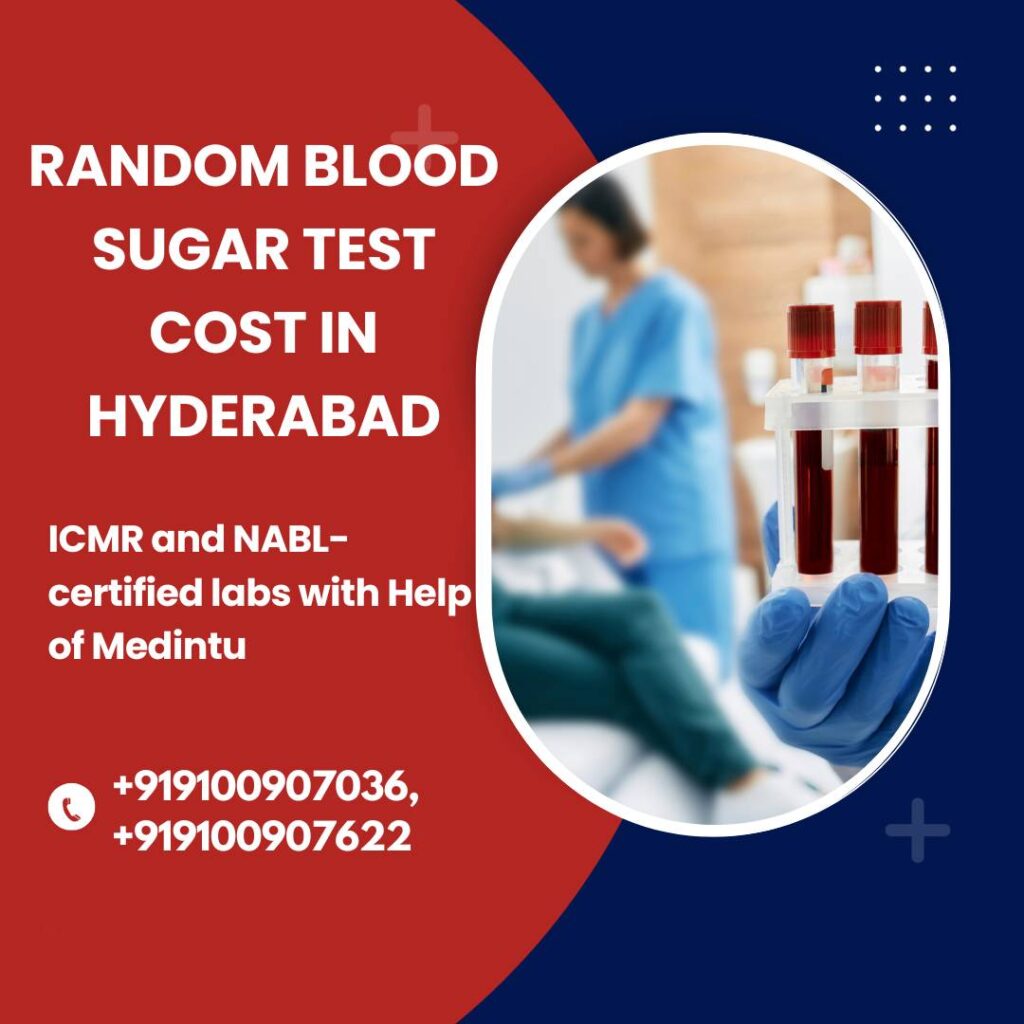 random blood sugar test