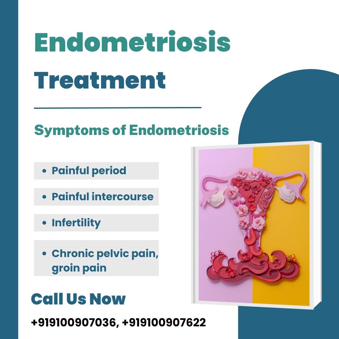 Endometriosis Treatment Medifyhome Endometriosis treatment medifyhome