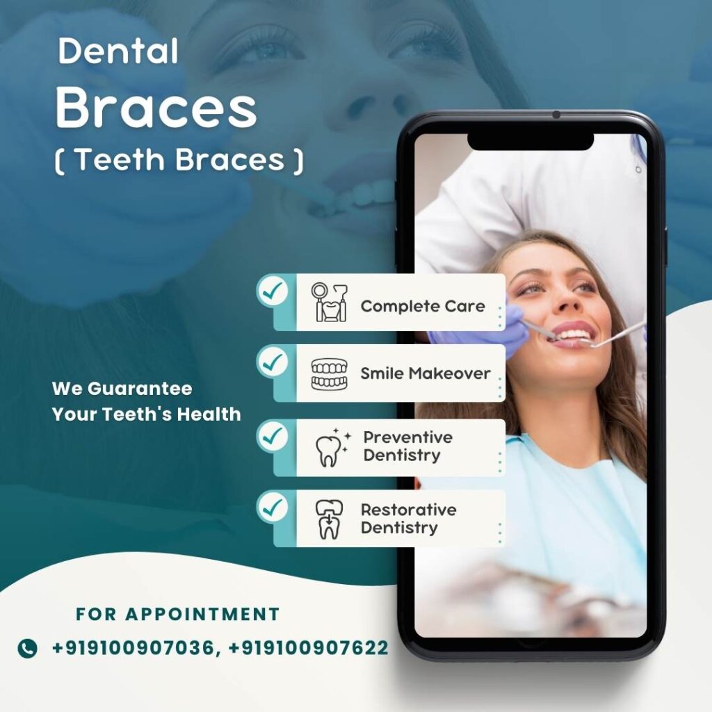 Dental Braces treatment in hyderabad