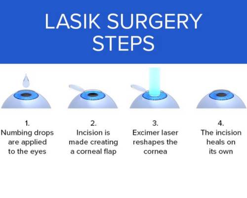 Lasik Eye Surgery in Hyderabad