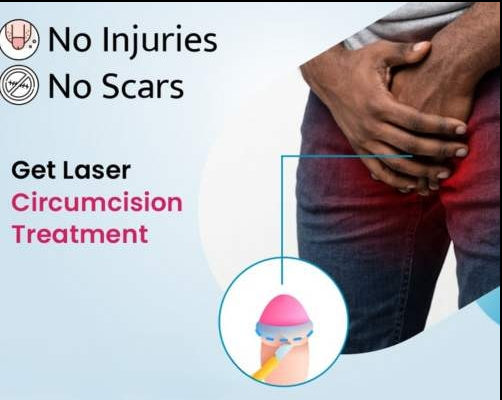 Laser Circumcision in Hyderabad