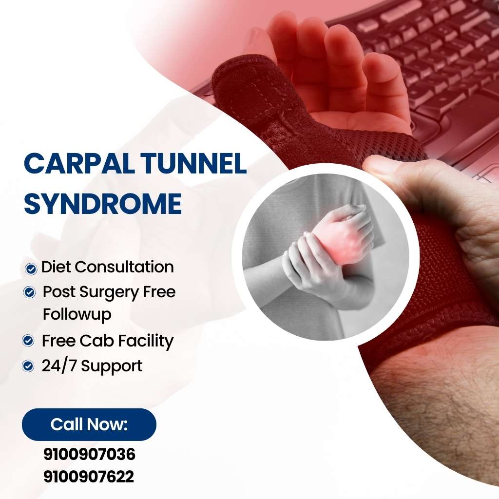 Carpal Tunnel Syndrome Hyderabad