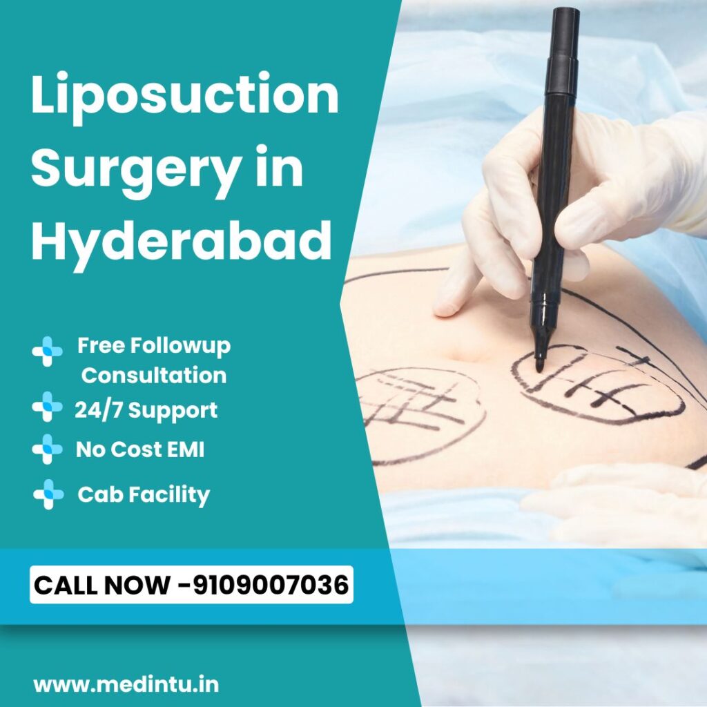 Liposuction Surgery in Hyderabad