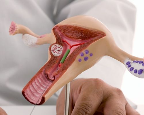 iui treatment