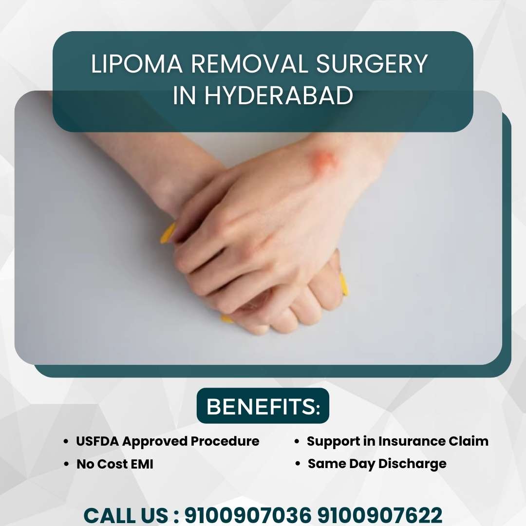 Lipoma Removal Surgery in Hyderabad