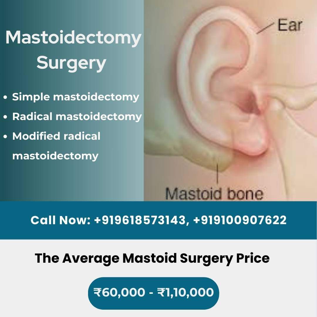 Mastoidectomy Surgery cost