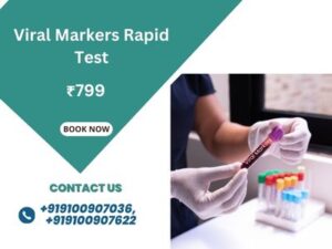 Viral Markers Rapid Test