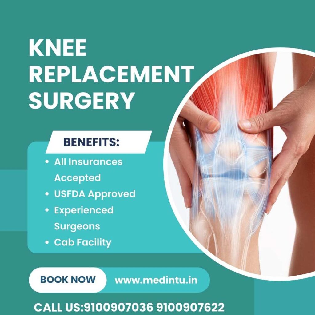Knee Replacement Surgery